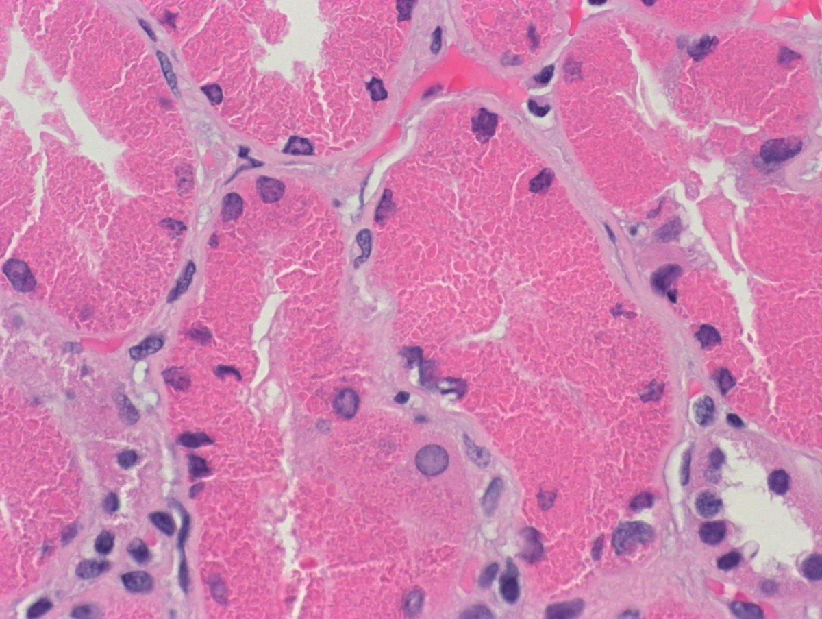 Kuang-Yu Jen, MD, PhD tweet media