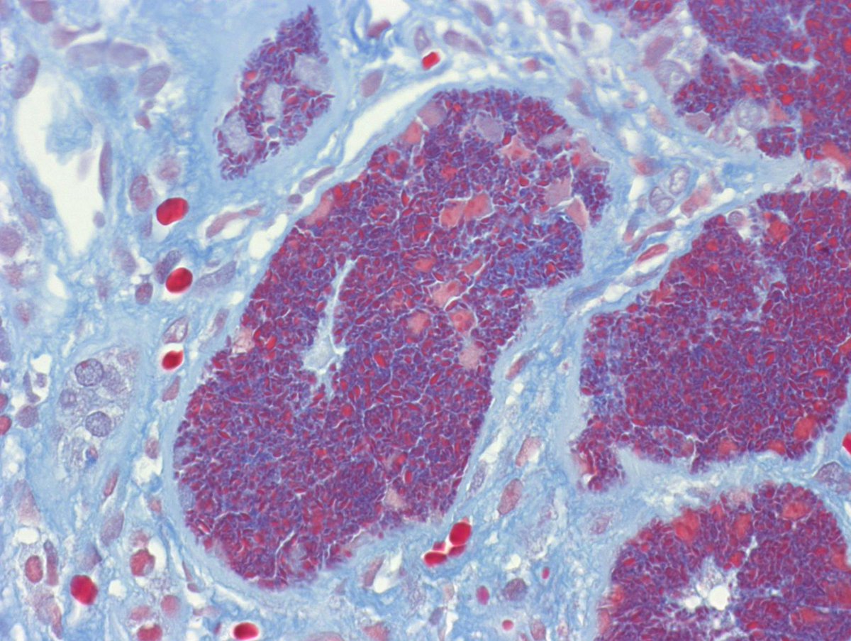 Kuang-Yu Jen, MD, PhD tweet media