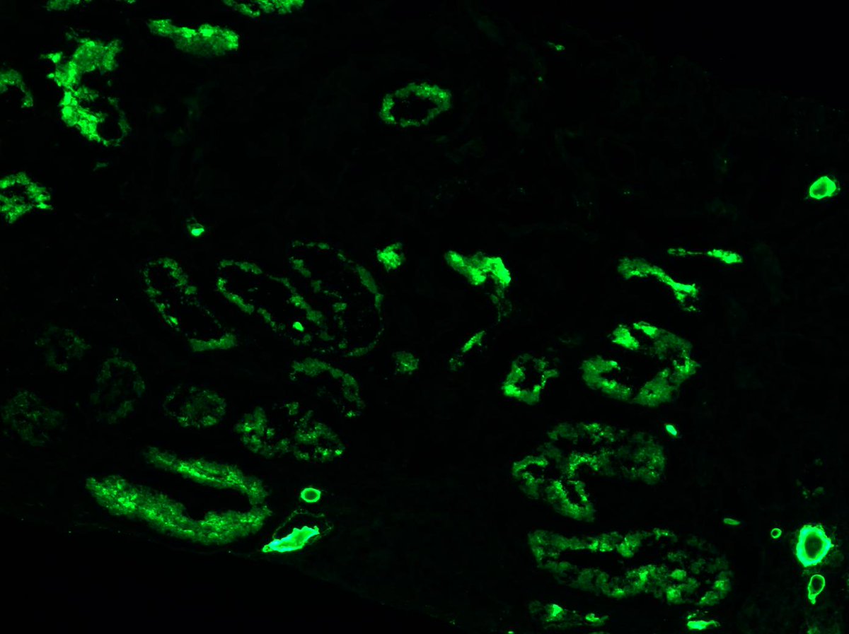 Kuang-Yu Jen, MD, PhD tweet media