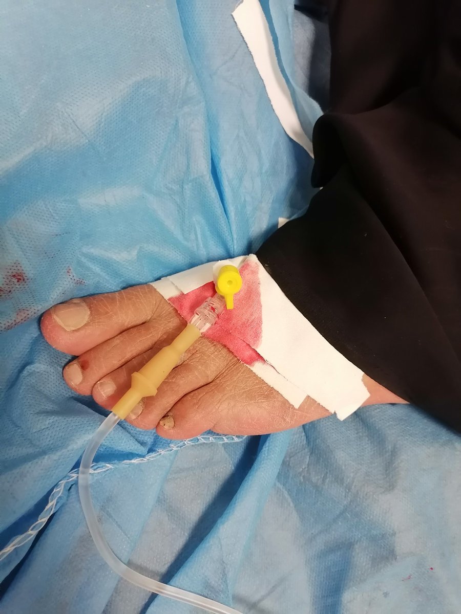 nono98m's tweet photo. شلون كانوله معدله🌚
#زياده_خطوره_الجيش_الابيض https://t.co/i3I7L5kXF0