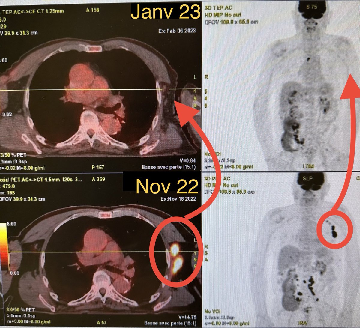 Dr Jérôme BARRIERE, MD. tweet media