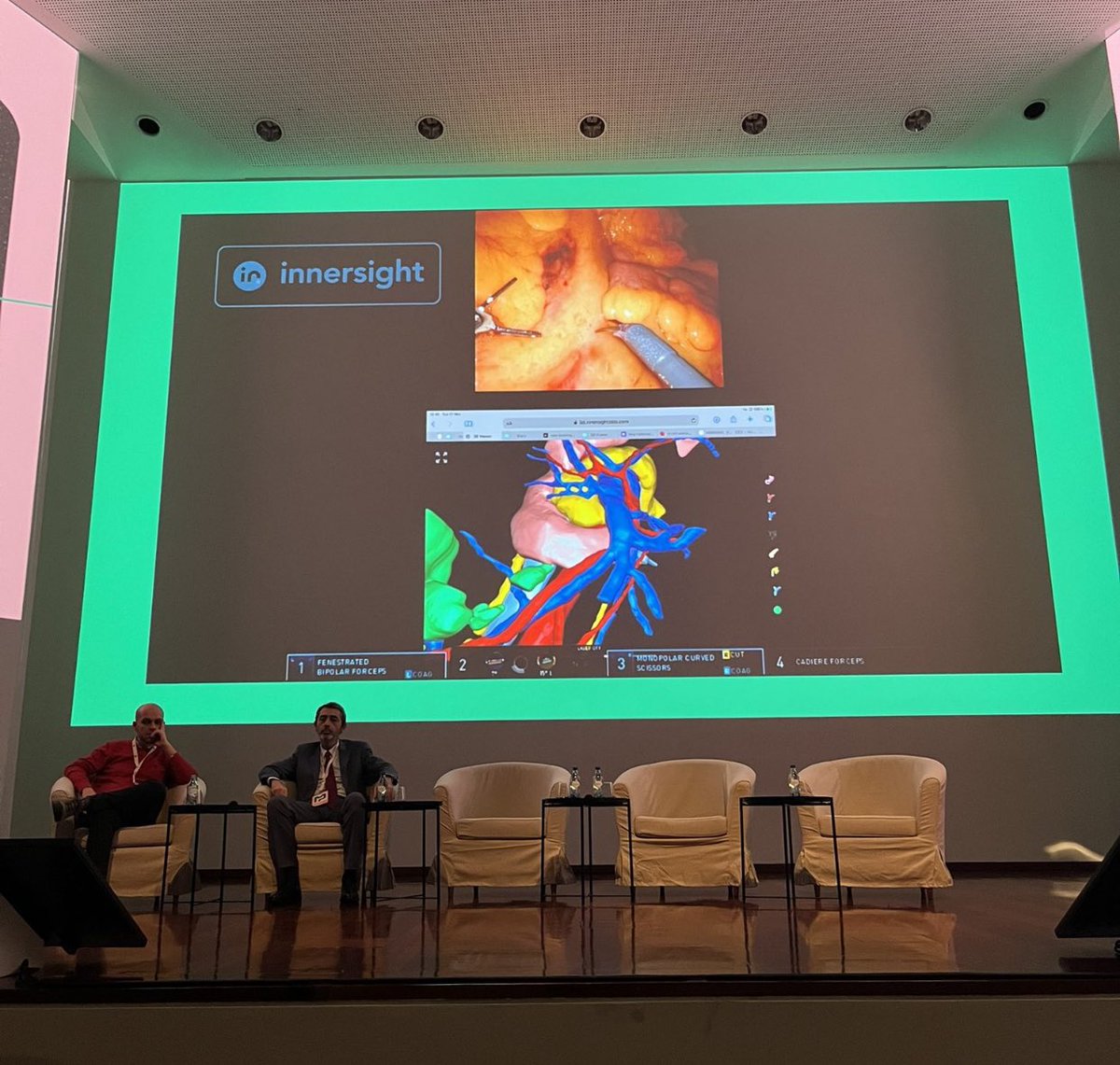 MiguelCunhaSurg's tweet photo. @ChampalimaudF congress‼️

Impressive discussions‼️

✅From colon cancer 

✅To watch &amp; wait / MDT discussion 

✅Beyond surgery Cutting-edge subjects! 

#SoMe4Surgery #colorectalcancer https://t.co/zXhkvYbRj4