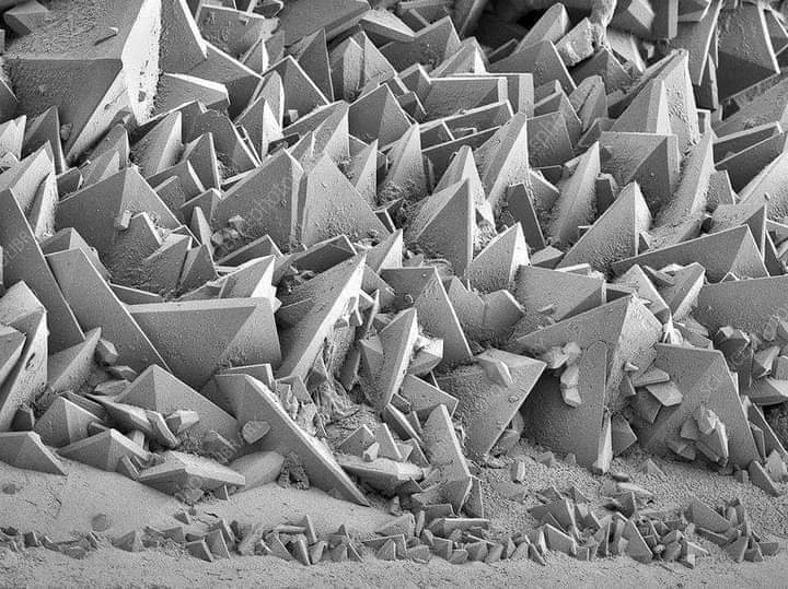 Informcosmos's tweet photo. Cálculos renales bajo el microscopio electrónico. https://t.co/LE8jndzlUA