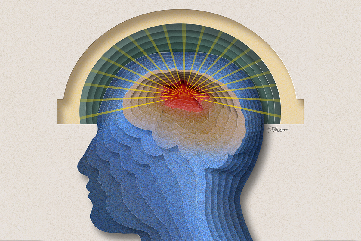 UCSF Neurosurgery (@neurosurgucsf) on Twitter photo The blood-brain barrier prevents many cancer therapies from reaching brain tumors. This year, the UCSF Brain Tumor Center will be opening multiple clinical trials that use focused ultrasound to safely and temporarily disrupt this barrier: braintumorcenter.ucsf.edu/news/focused-u…
<a href="/UCSFCancer/">UCSF Helen Diller Family Comprehensive Cancer Ctr</a> The blood-brain barrier prevents many cancer therapies from reaching brain tumors. This year, the UCSF Brain Tumor Center will be opening multiple clinical trials that use focused ultrasound to safely and temporarily disrupt this barrier: braintumorcenter.ucsf.edu/news/focused-u…
<a href="/UCSFCancer/">UCSF Helen Diller Family Comprehensive Cancer Ctr</a>