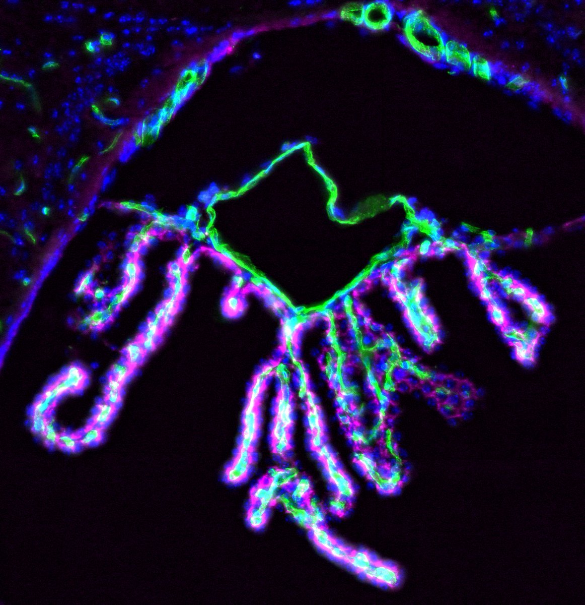 Neurobiology Imaging Facility at Harvard Medical (@hms_nif) on Twitter photo #microscopymonday image by <a href="/xjdumaine/">Xavier J. du Maine, PhD</a>, <a href="/GuLabNeuro/">The Gu Lab</a> using our #VS120 slide scanner
Here is the mouse choroid plexus, a structure in the brain ventricles that produces a clear fluid called CSF that helps to protect the brain and clear waste from it. The choroid plexus consists... #microscopymonday image by <a href="/xjdumaine/">Xavier J. du Maine, PhD</a>, <a href="/GuLabNeuro/">The Gu Lab</a> using our #VS120 slide scanner
Here is the mouse choroid plexus, a structure in the brain ventricles that produces a clear fluid called CSF that helps to protect the brain and clear waste from it. The choroid plexus consists...