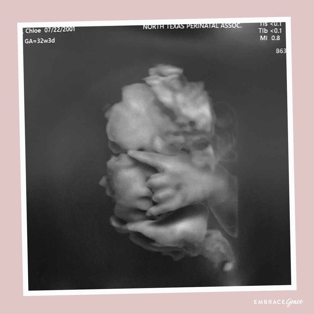 Happy Valentine’s week! 💗🤟🏼 

How precious is this sonogram from one of our alumni?! Tellin’ mama “I love you’ while still in the womb! We pray you know how LOVED you are this week (&amp; every week)! 

#prolove #embracegrace #helpherbebrave
