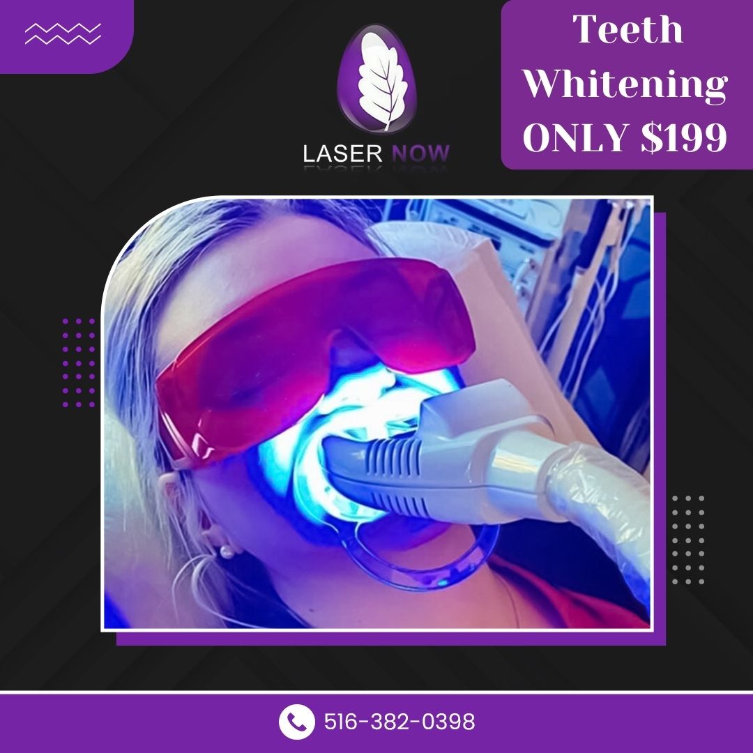 There's always time for a shining smile! 😀✨
#teethwhitening #teethbleaching #zoom #brightsmile #whitesmile #cleanteeth #whiteteeth #eventready #eastmeadowmoms #lasernow #eastmeadow #longisland #newyork