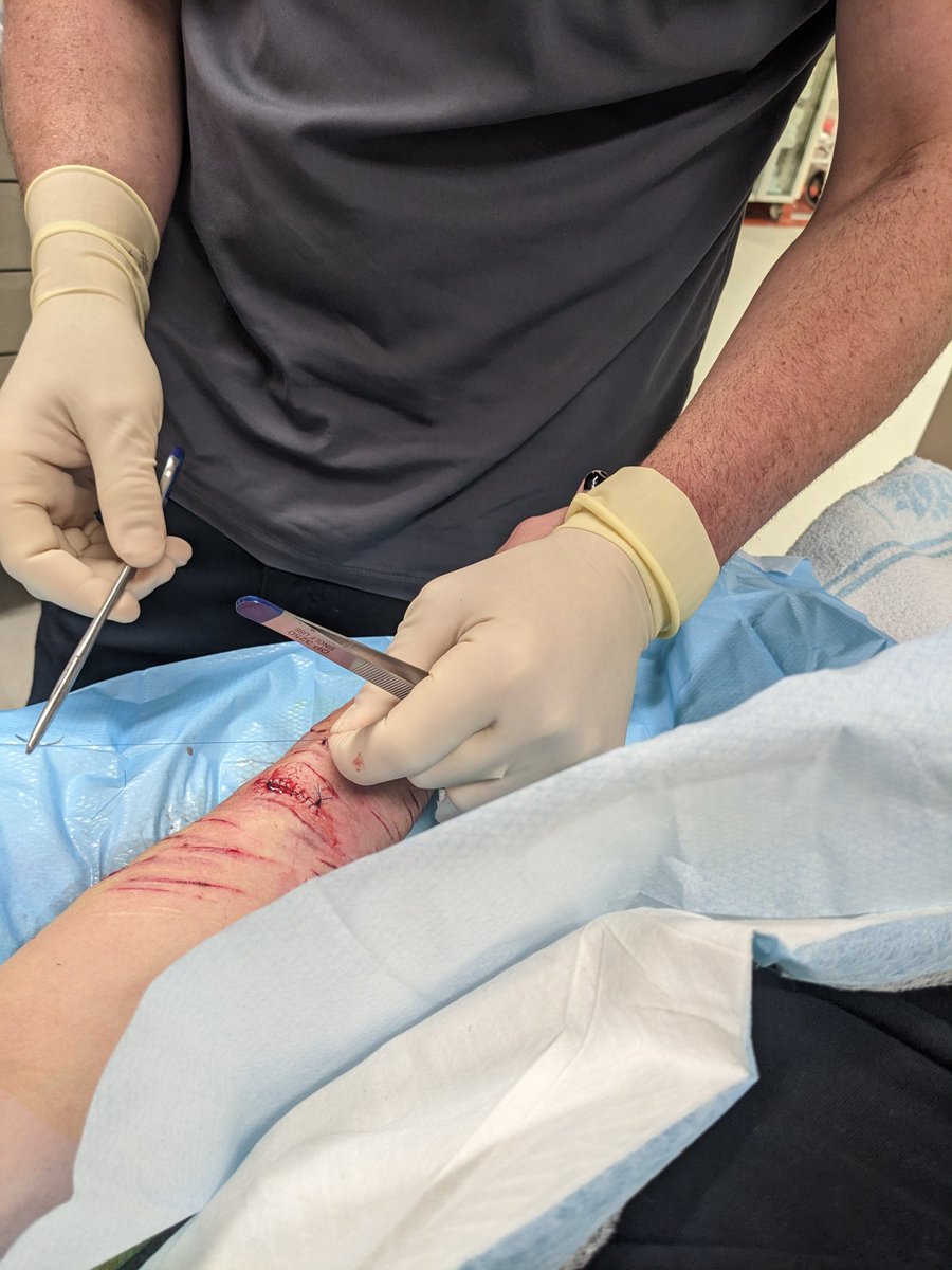 pagancals's tweet photo. tw//sh 

from when i was getting stitches 🕺🕺

🏷️ shtwt 988twt https://t.co/31iDxwtgra