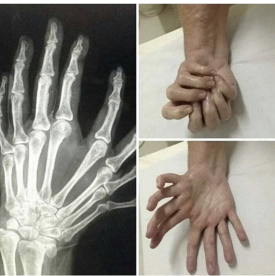 In reality extra fingers may be a burden, but if it was advantageous, what would you use them for?