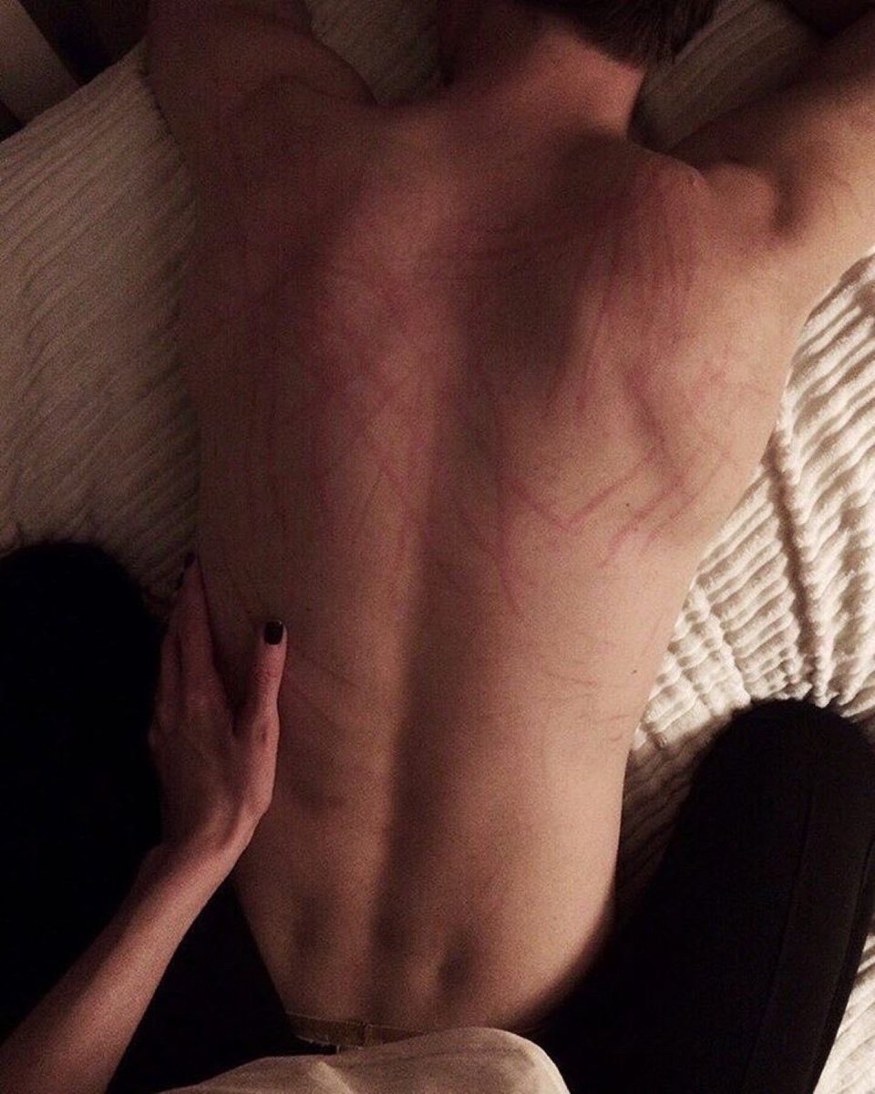 NyaNightshade's tweet photo. Kitty has claws :3 https://t.co/Wy4VqTUr1m