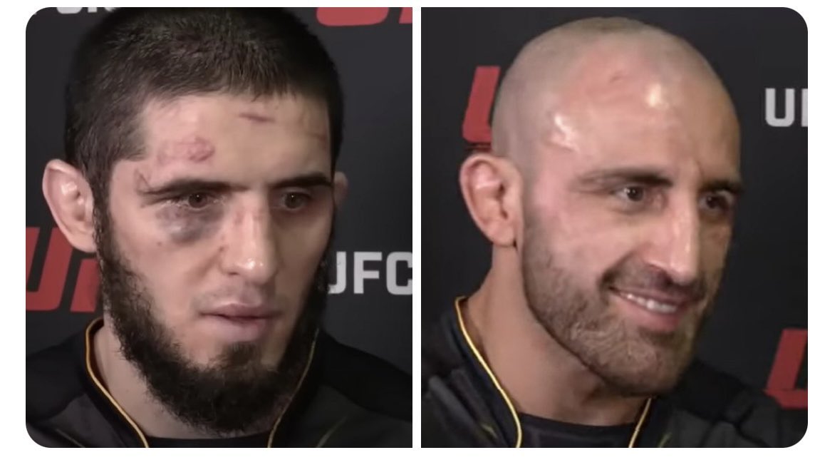 CallumRoss03's tweet photo. @dapursempril @973_MMA @SpinninBackfist Yes more damage https://t.co/PDBt6OyxJK