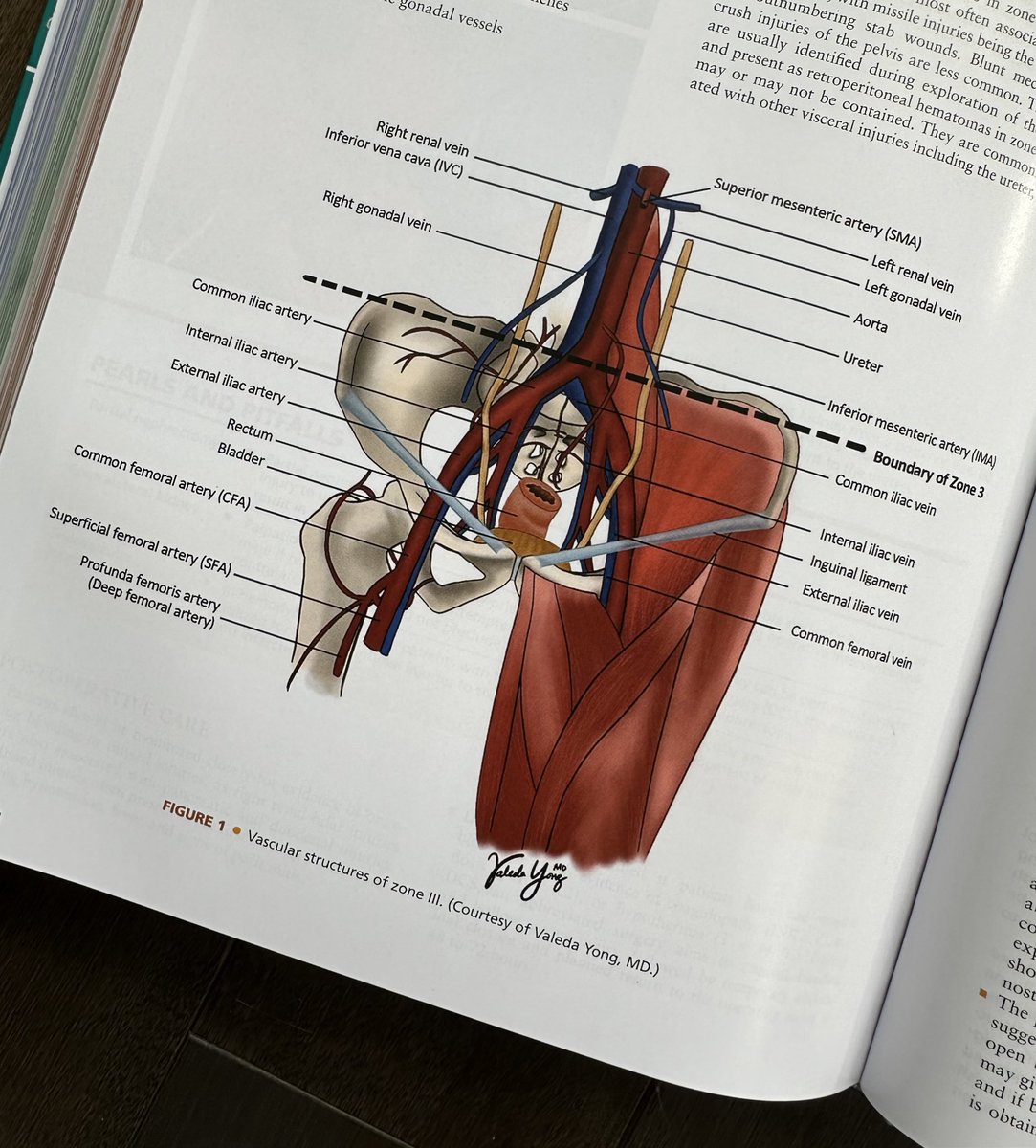ValedaYongMD's tweet photo. Very excited to receive this in the mail today! Grateful for the opportunity to contribute and illustrate for a part of this amazing publication. Thank you @maryhawn, @AJGTempleSurg, @zoe_maher, @jessicahbeard, @Lizddauer, @APathakMD, @TempleSurgery, @TempleTrauma @TempleSurgRes https://t.co/Urg17NRxDa