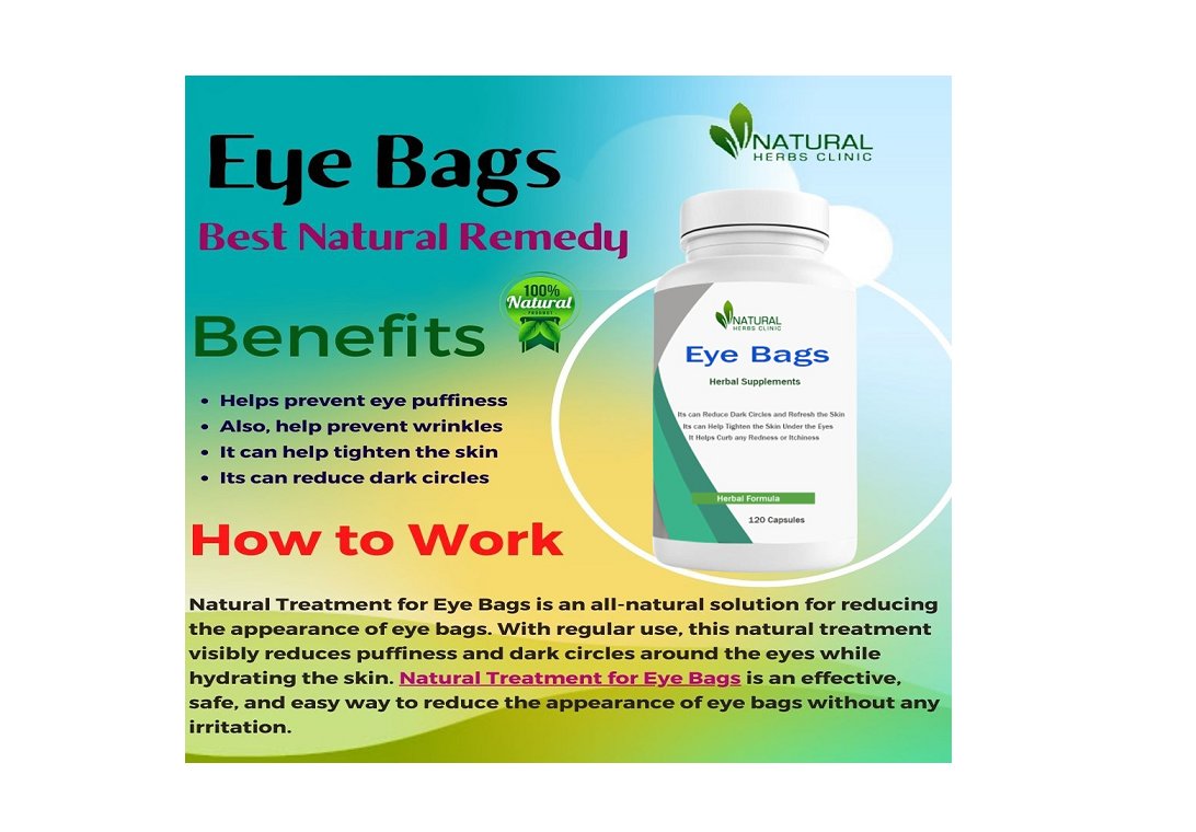 Natural Remedies for Eye Bags Get to Recover your Eye Condition