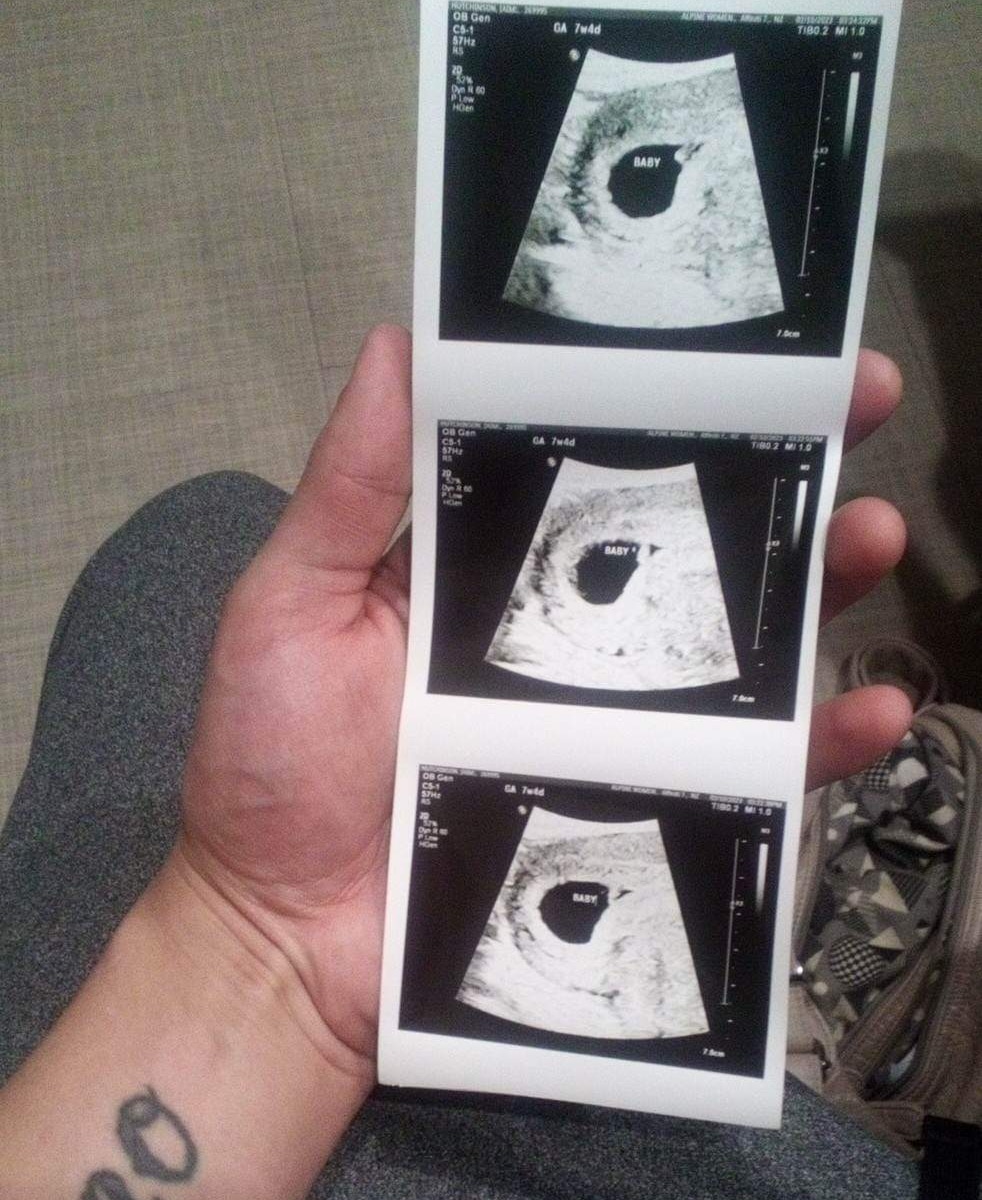 MedranoDano's tweet photo. Another generation will be born! https://t.co/ntXd7stgkv