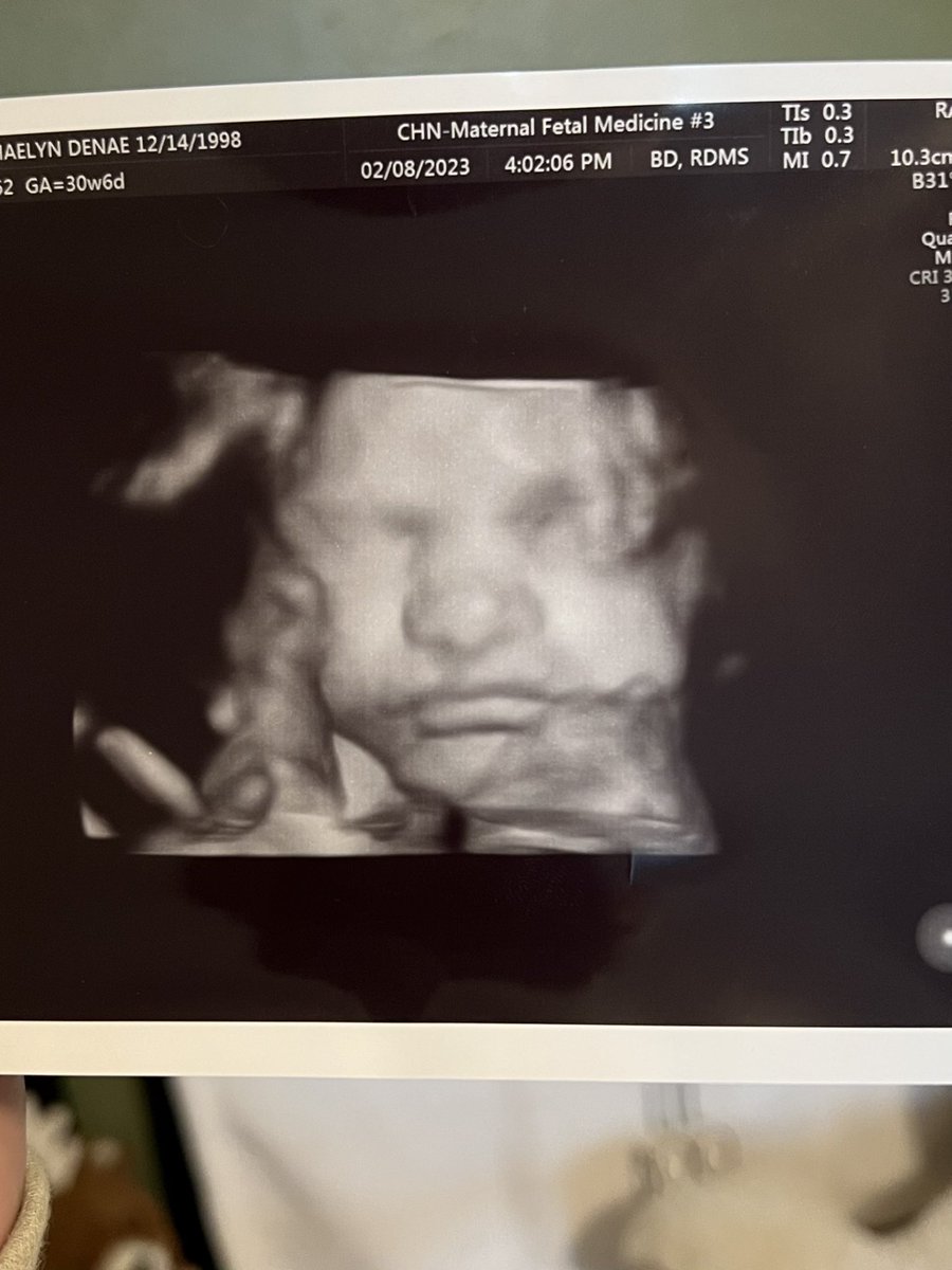 shaelyn bougher tweet media