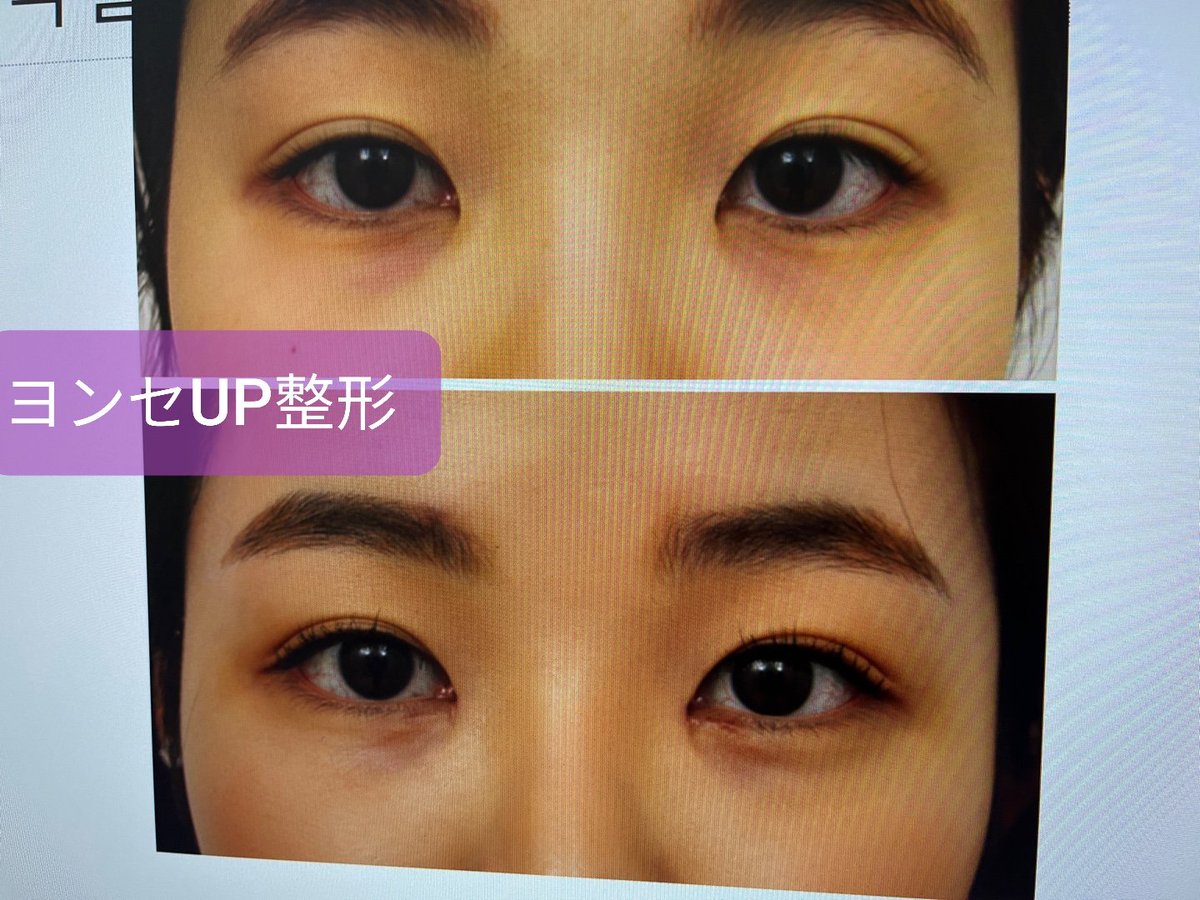 スタート整形外科&ヨンセUP整形病院の案内 tweet media