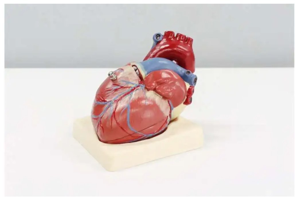 sadirichards5's tweet photo. Heart failure places a great strain on health care, new study finds https://t.co/tpJpXHGVLK