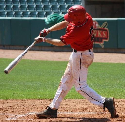 orthoEMpearls's tweet image. 25yo was taking some batting practice  preparing for softball league when developed pain over the ulnar aspect of his palm. What is the diagnosis? ⚾️ #FOAMed #FOAMrad #EmergencyMedicine #SportsMed