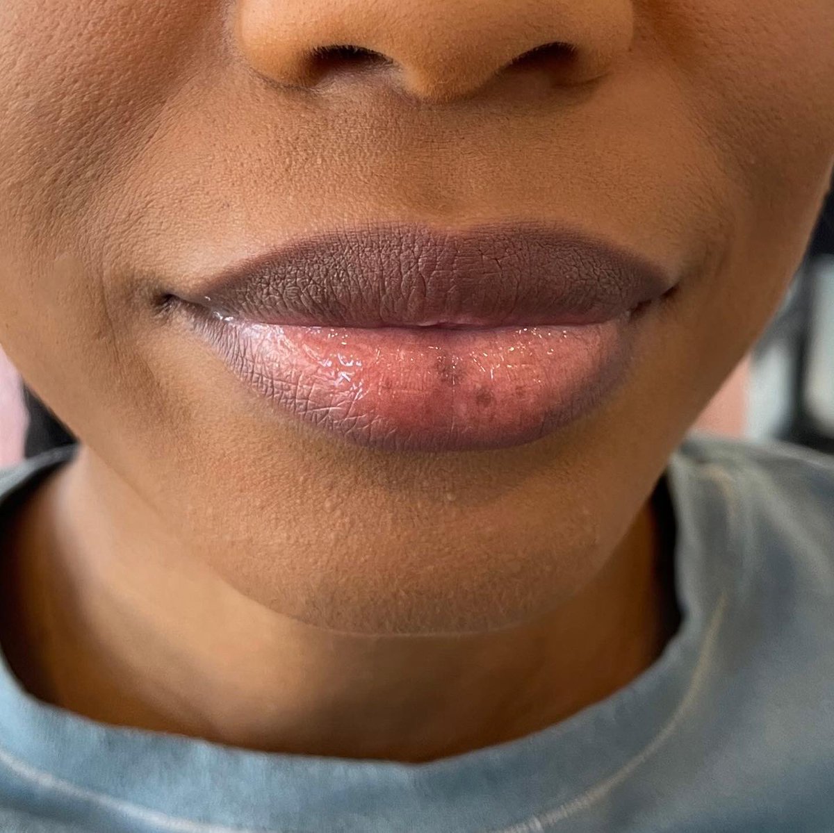 exquisid_'s tweet photo. Okay but can we get into how good her lips already look after only ONE session. 😍😍😍
(BEFORE• IMMEDIATELY AFTER•2 WEEKS LATER) #lipneutralization
exquisid.esthetics on Instagram - https://t.co/NB4nB1IVxy https://t.co/NfYX1pK6p6