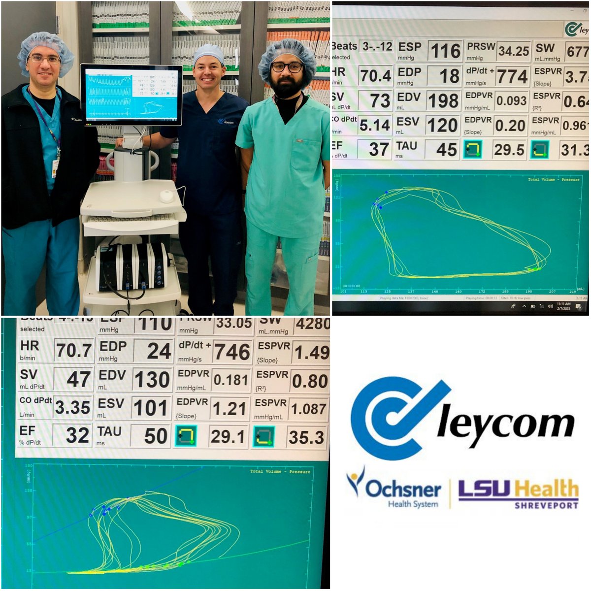 PSullivan000's tweet photo. First clinical #PVloop case in Louisiana. Congrats to the @LSUHS team!
Link: https://t.co/5y5L9cXRZZ
#pvloops #hemodynamics #heartfailure #structuralheart #cardiology #cardiotwitter #preload #afterload #valsalva #PVL #lvad #tavr #TMVR https://t.co/TmvHqCRA5a