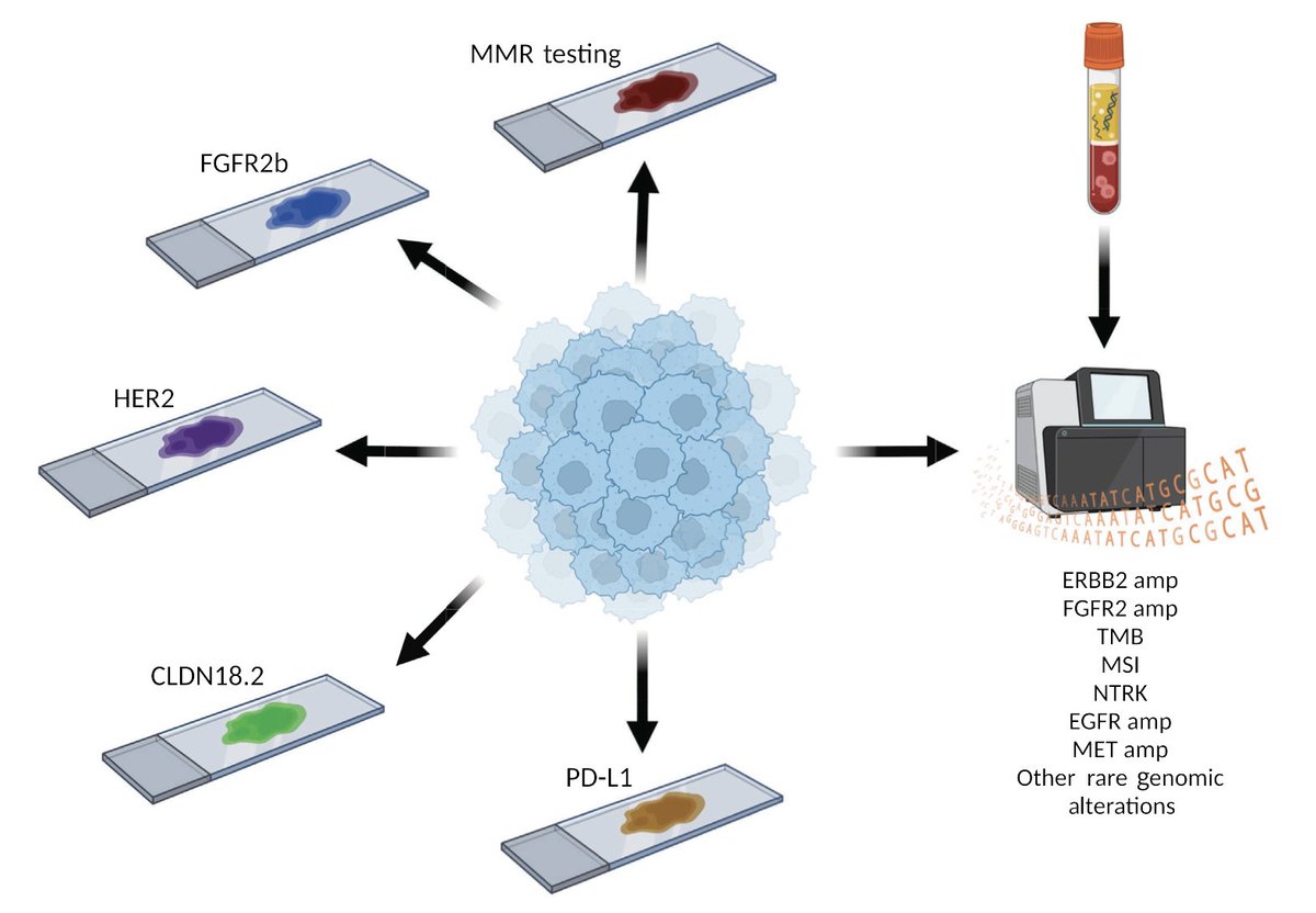 🔥Claudin18.who? Examining biomarker overlap and outcomes in claudin 18.2+ g astroesophageal adenocarcinomas
<a href="/ESMO_Open/">ESMO Open</a> 
doi.org/10.1016/j.esmo…
👏Very nice editorial
👉Gastric cancer on the way to #PrecisionMedicine  
<a href="/myESMO/">ESMO - Eur. Oncology</a> <a href="/OncoAlert/">OncoAlert</a>