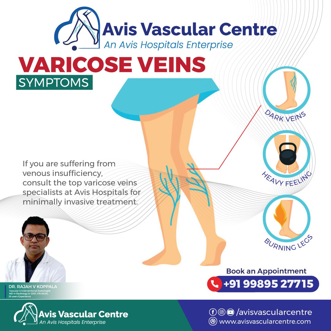 VARICOSE VEINS  SYMPTOMS 

If you are suffering from venous insufficiency, consult the top varicose veins
specialists at Avis Hospitals for minimally invasive treatment.

#AvisHospitals #varicoseveins #varicoseveintreatment #doctor #DrRajahVKoppala #surgeon #LaserSurgery