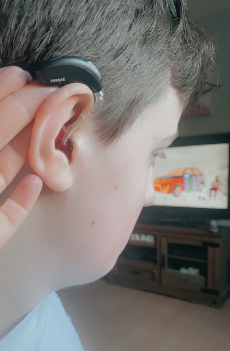 mskashort's tweet photo. Things I’m loving today…. #technology ! Well done @phonak my son and daughter have both been upgraded @IOWNHS  to these super cool rechargeable #bluetooth #hearingaids half the size of their old aids, and no more tiny batteries! #deafawareness #audiology #14february #deaf #love https://t.co/Zi3nI65ZTL