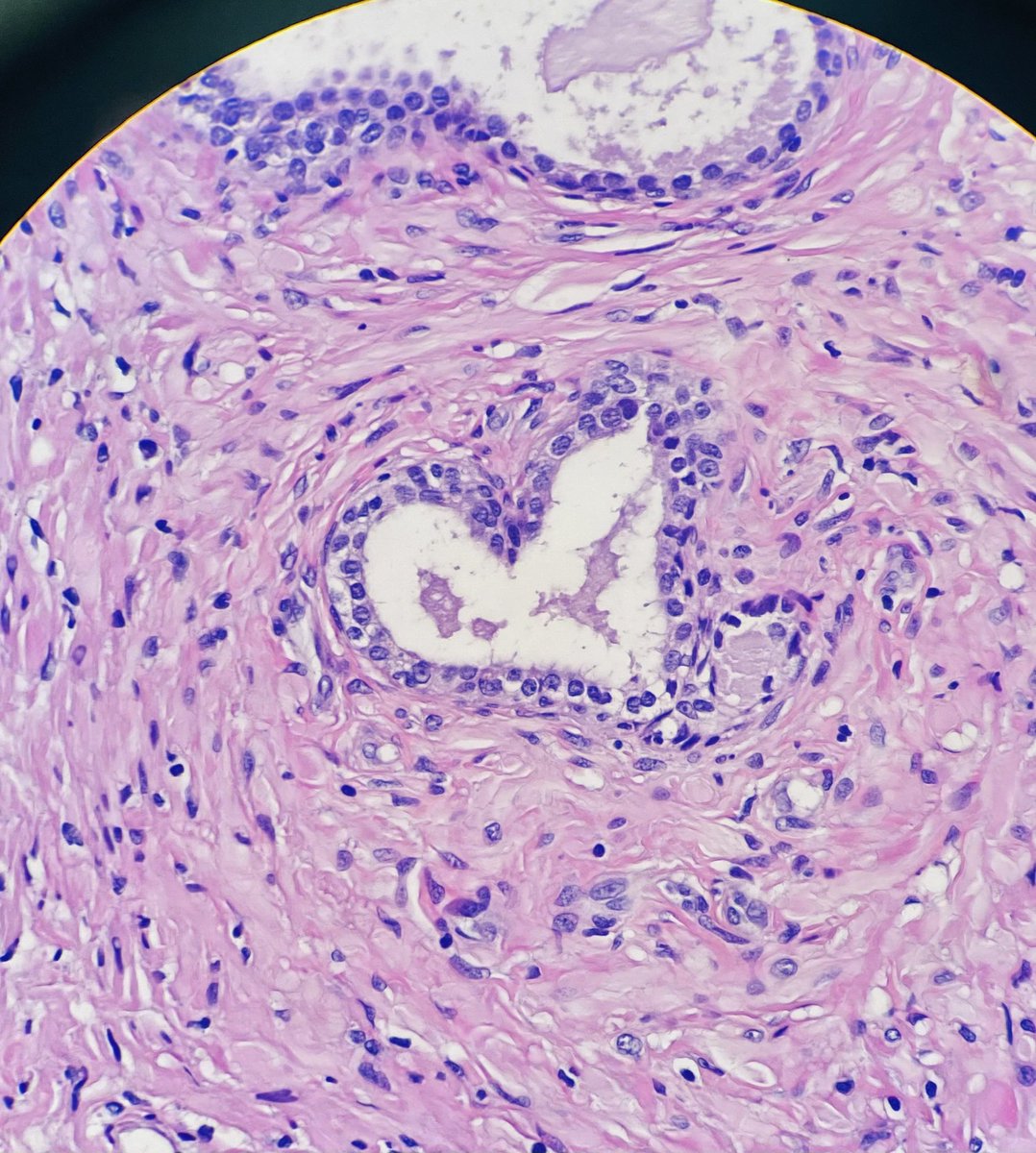 Happy Valentines day! 💜 #PathTwitter  #ValentinesDay #pathology