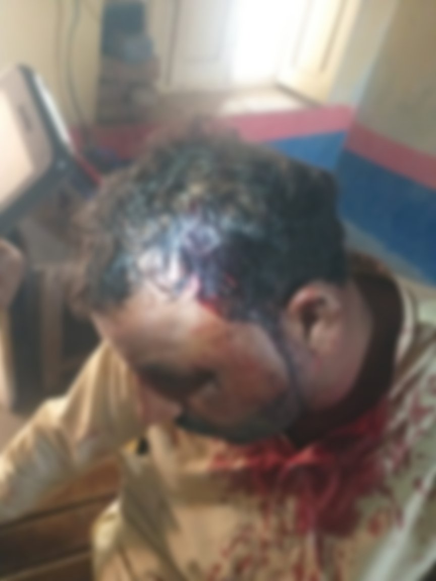 khalidkoree's tweet photo. قمبر شهدادڪوٽ، تعلقو وارھ يوسي بهرام ۾ محمد مٺل مگسي ۽ ان جي گهر ڀاتين تي پيپلزپارٽي جي ضلعي ڪائونسل جي ميمبر پاران تشدد پوليس سهڪار ڪرڻ کان عاري. 
@DMCSindhPolice https://t.co/Z4jYUBBpeO
