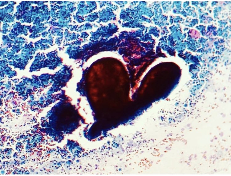 fifia_la's tweet photo. Happy Valentine’s Day 💘 #ValentinesDay2023 #SanValentin #Citologia #citopath #pathart #cytology https://t.co/wf7CmToEKD