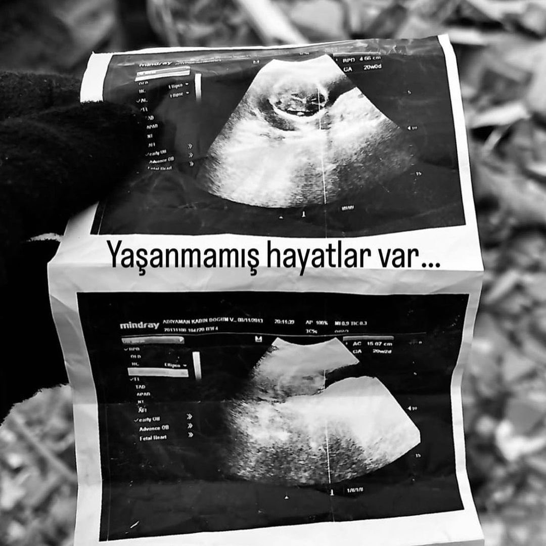 rodyagibi's tweet photo. Yaşanmamış hayatlar var...

#deprem https://t.co/wSVhqyRnHj
