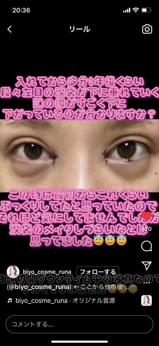 mikutanRails's tweet photo. 涙袋入れない方がいいのかな… https://t.co/uyPlZpfIFg