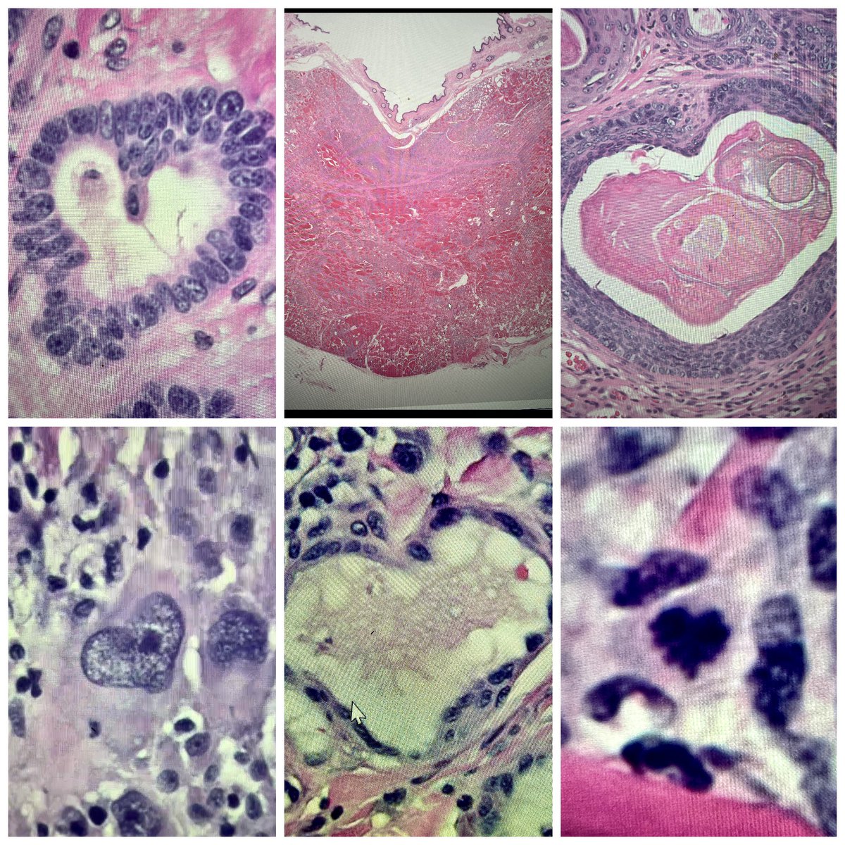 vetpathnerd's tweet image. #HappyValentinesDay #pathart