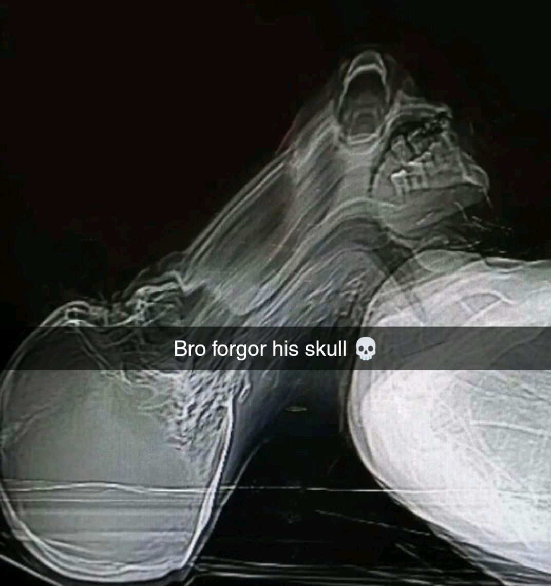 CursedCreepy's tweet photo. #cursed #creepy #unnervingimages #dreadful #cursedimages #scary #creepyart #cursedimage #weirdcore https://t.co/DcSRN5se7F