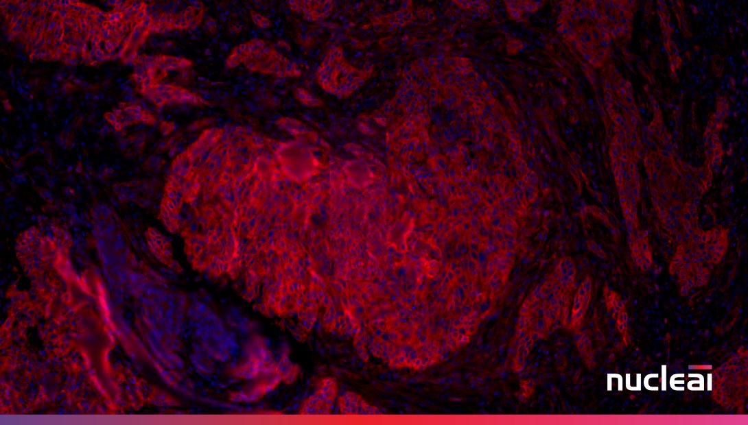 nucleai_ai's tweet image. As the old saying goes, love is in the small details, but for us Nucleai-ers, love is in the spatial details. Happy Valentine's Day ❤️
 #HappyValentinesDay #spatialbiology #spatialinsights #immunooncology #immunotherapy #oncology #precisionmedicine