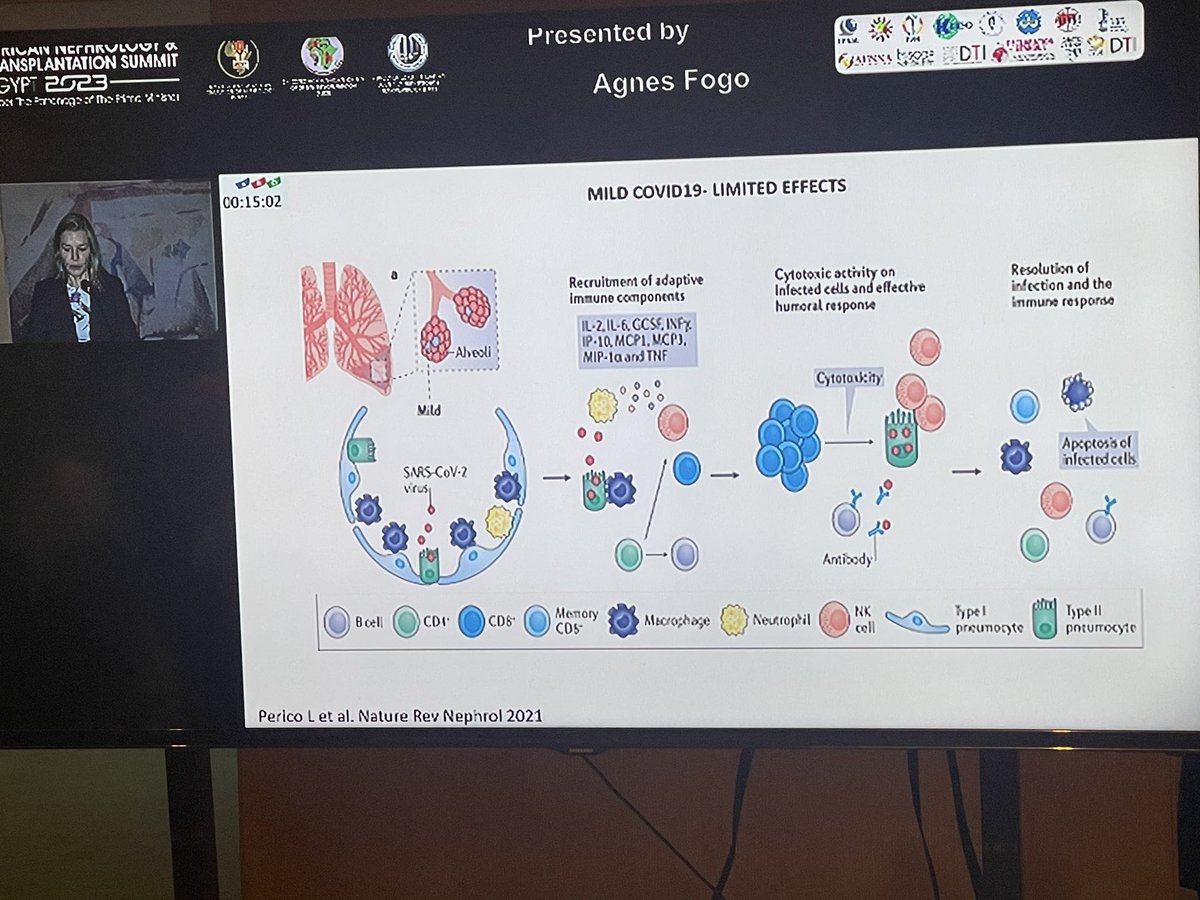 Gawad_Nephro's tweet photo. Prof @AgnesFogo presenting about COVID 19 and the kidney at #AFRAN2023 #ESNT2023 
@ISNkidneycare https://t.co/2X3LUBtPs1