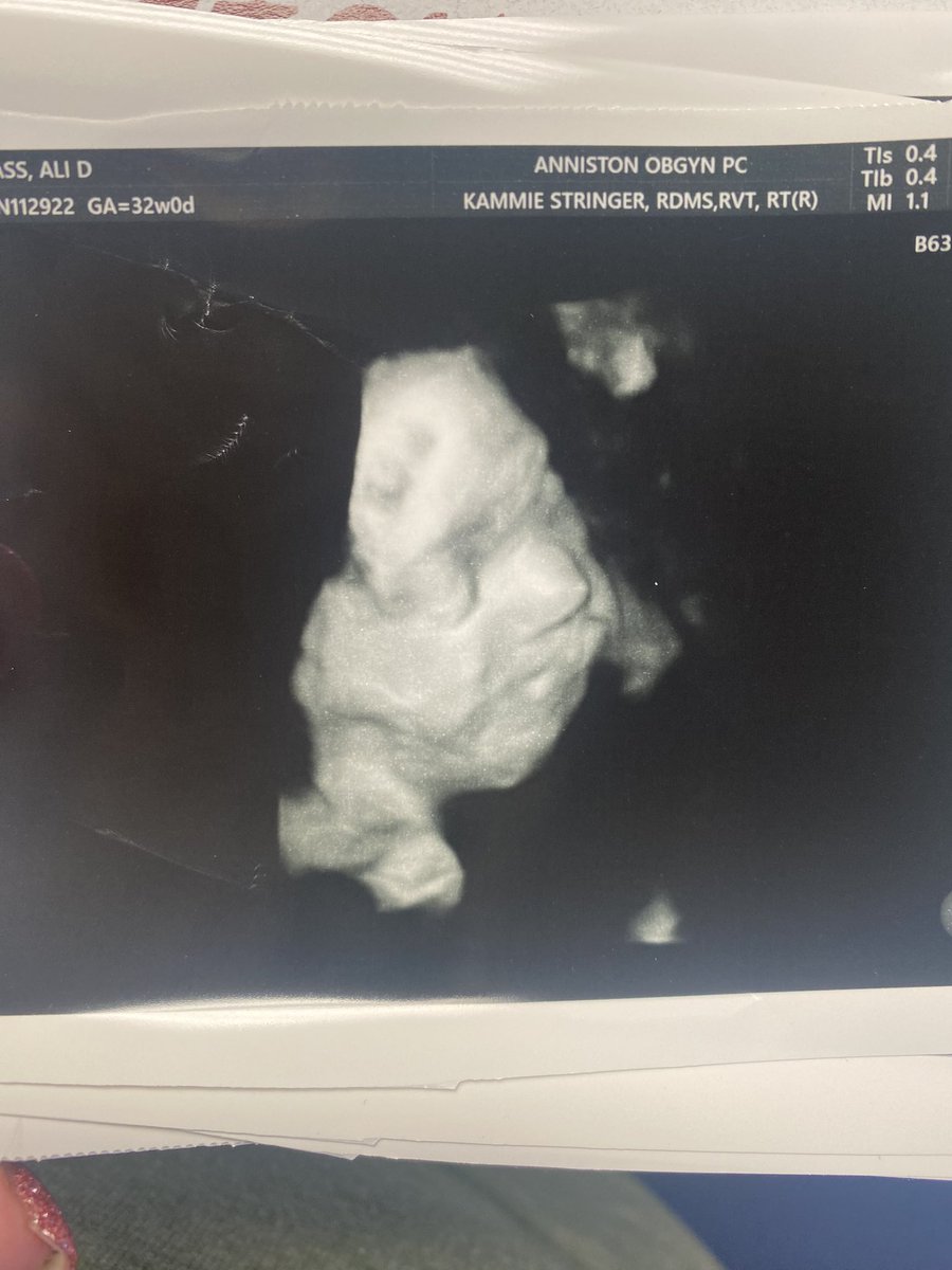 AliDevinn's tweet photo. Lainey Alisyn Rae.. we can’t wait to meet you ♥️ https://t.co/2DX6hUMNv2