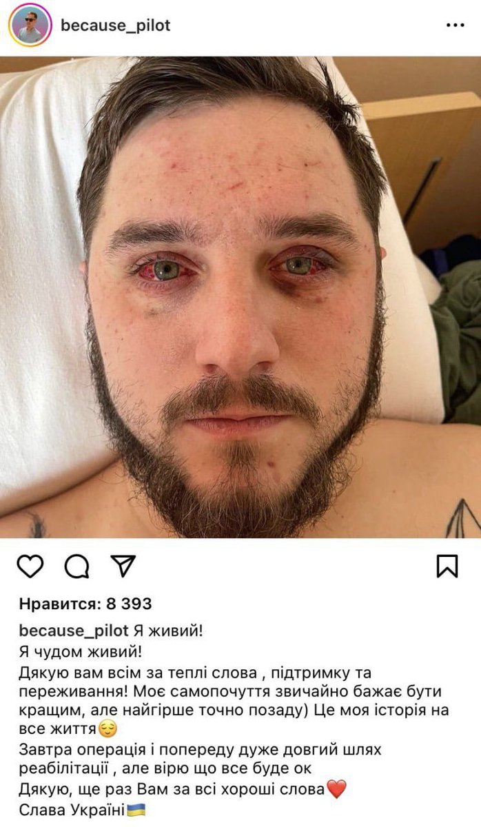 Comedy world😂

Yesterday Ukrainian Air Force bragged about “hunting” Shahed drones.

Today, Shahed drone downed a MiG-29 (piloted by Officer Dmitry Shkarevsky)

This is the third kill for the Shahed-136. not bad for a kamikaze drone