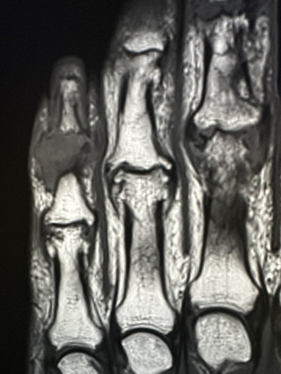 Likely dx?
