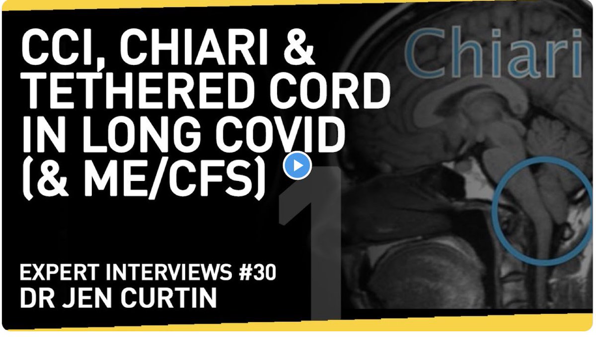 First part of a series about #Chiari #TetheredCord #CCI & the question: What do they have to do with #MEcfs & #LongCovid?
#Infections #Mastcells #Ligaments #DegradeCollagen ‼️
Thanks to @gezmedinger @doctorasadkhan & @jencurtinmd 
Important & unfortunately often overlooked topic!
