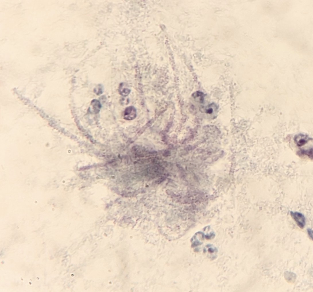 PSzwebel's tweet photo. What Is your opinion about this photo?
Is this image a spider?
Is this image an Actinomyces sp? https://t.co/VKMVZ6MAmz