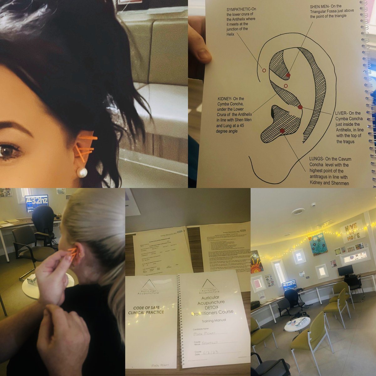 Amylowry๐ (@amy_lowry_) on Twitter photo ๐๐๐๐๐๐๐๐๐๐
Today our fabulous Mark & Lyndsey OT showed us their new group - Acupuncture, and the great benefits,
great addition to our weekly planner
Greatly received by SU & staff
๐<a href="/JosephOgbeide4/">Joseph Ogbeide</a>
๐<a href="/AmeliaGMMH/">Amelia Barlow</a>
๐<a href="/BenStrongGMMH/">Ben Strong</a>
๐<a href="/JanNewlands/">@Jan_Lowrynhs</a>
๐<a href="/GMMH_NHS/">Greater Manchester Mental Health</a> ๐๐๐๐๐๐๐๐๐๐
Today our fabulous Mark & Lyndsey OT showed us their new group - Acupuncture, and the great benefits,
great addition to our weekly planner
Greatly received by SU & staff
๐<a href="/JosephOgbeide4/">Joseph Ogbeide</a>
๐<a href="/AmeliaGMMH/">Amelia Barlow</a>
๐<a href="/BenStrongGMMH/">Ben Strong</a>
๐<a href="/JanNewlands/">@Jan_Lowrynhs</a>
๐<a href="/GMMH_NHS/">Greater Manchester Mental Health</a>