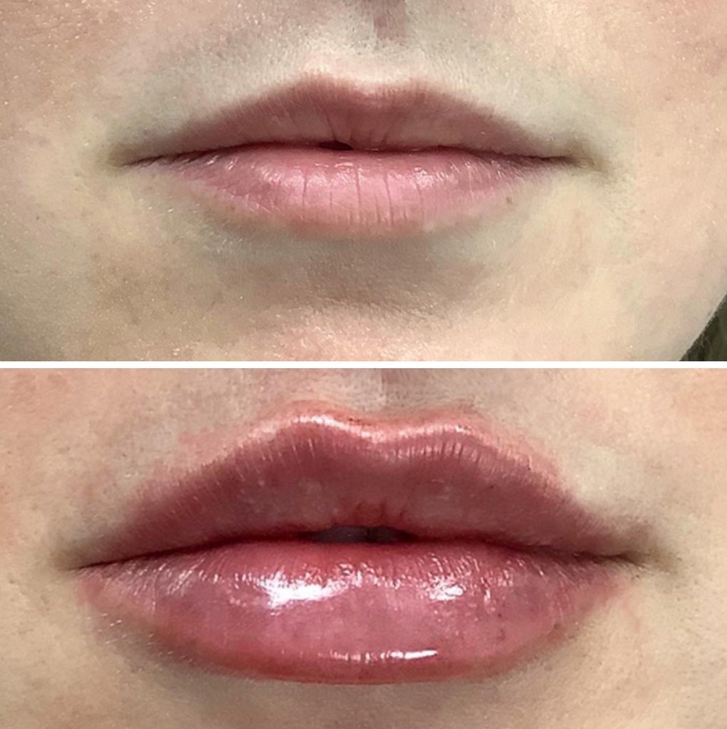 MD_Spa's tweet image. Contact us today:
Call: (780)9299797
Text: (780)9349021
DM: @MDSPALASER
Email: beaumont@mdspa.ca
Web: mdspa.ca

#edmonton #yeg #yeglocal #yegbusiness #alberta
#metime #beauty #wellness #selfcare #skin #acne #botox