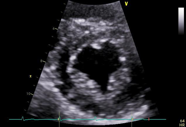 Happy #ValentinesDay, everyone! ❤️ #ASEHeart