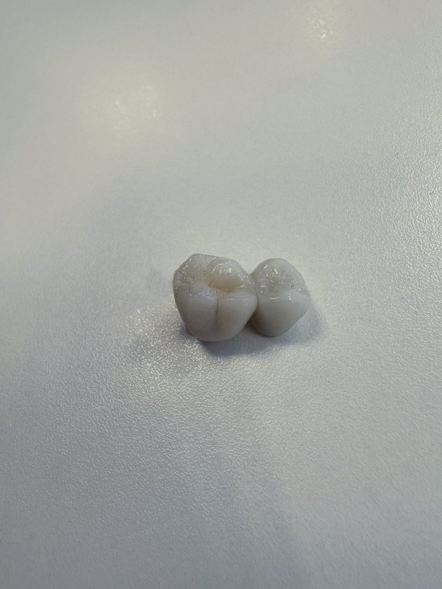 The_DannyNoonan's tweet photo. My Valentine’s Day date was unexpectedly the dentist. And they didn’t even offer to split the bill. https://t.co/xoVa3ENjK1