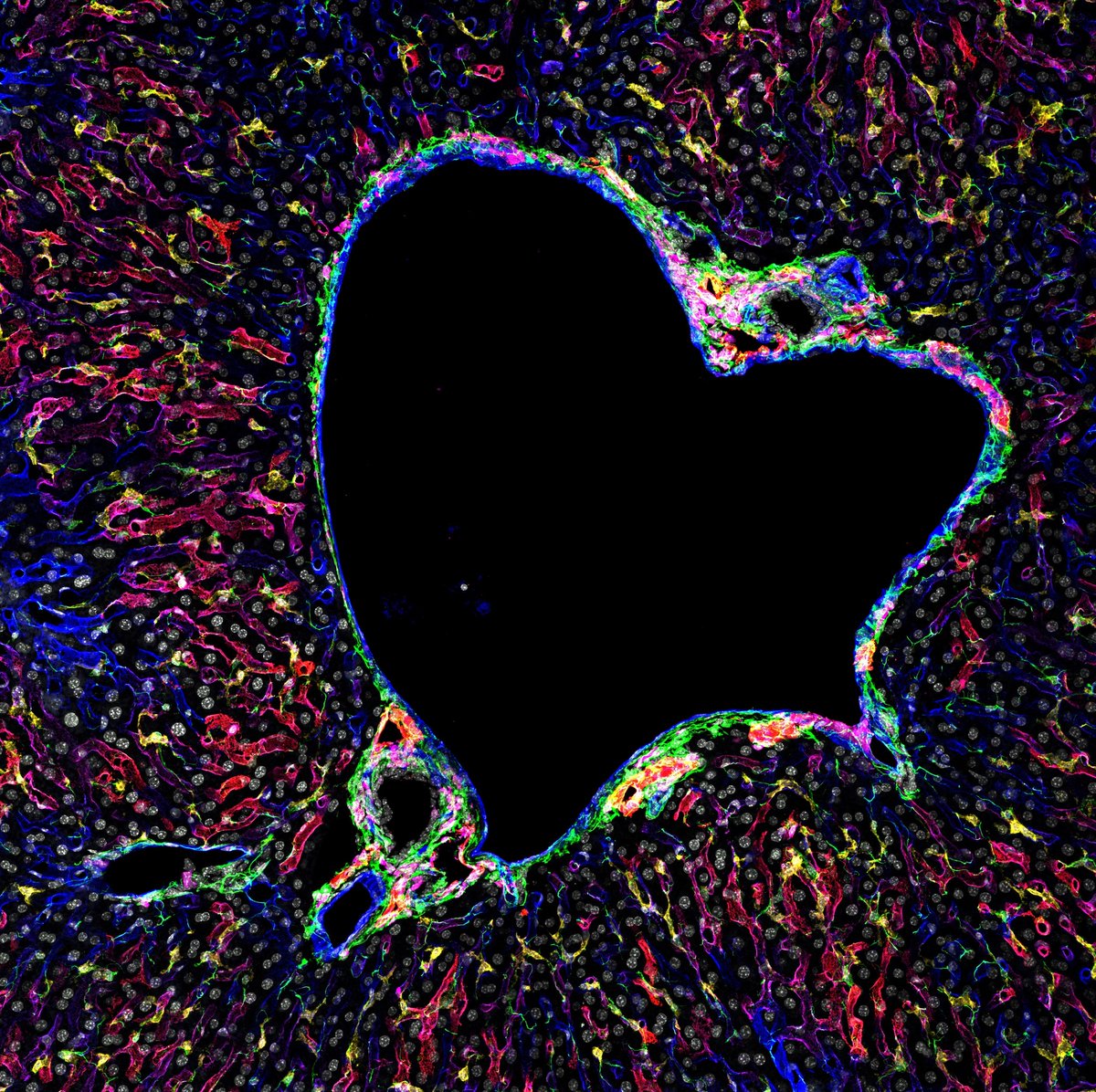 biohub's tweet photo. We ๐ซถ #CellBiology! This romantic image by Johnny Bonnardel in the @MartinGuilliams & @KC_DC_01 teams shows different liver cells by microscopy for the #LiverCellAtlas project https://t.co/hJ5T2kj2uM https://t.co/obuhMas96b