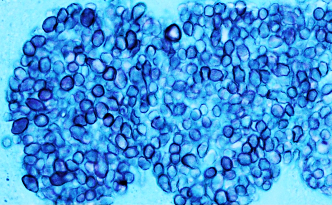 Mayo Clinic Infectious Diseases tweet media