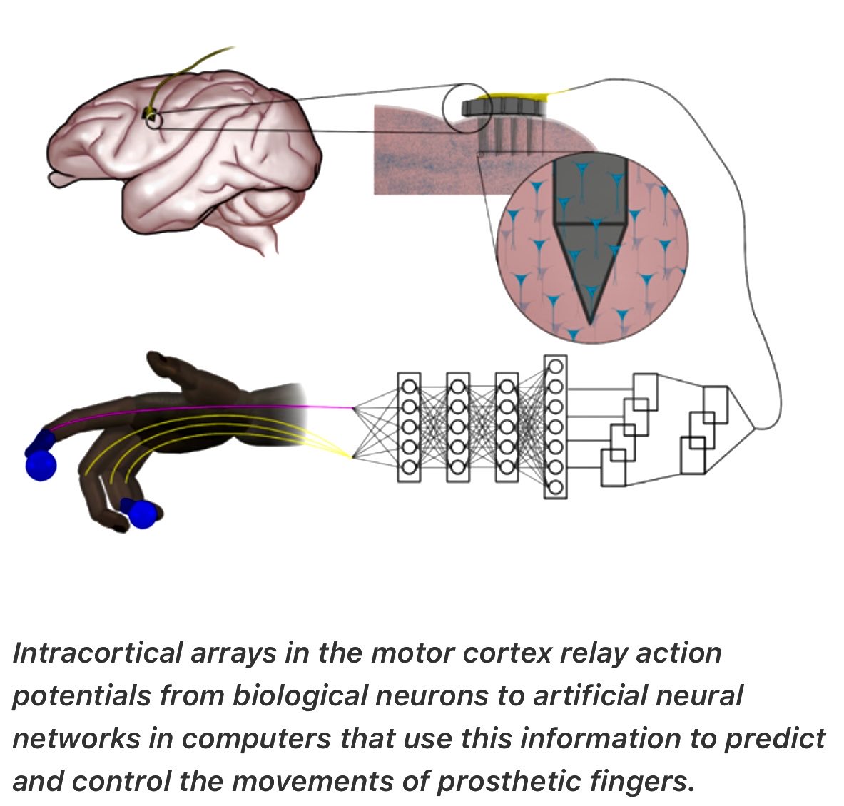enilev's tweet photo. Simple #NeuralNetworks Outperform the State-of-the-art for Controlling #Robotic #Prostetics @UMichiganNews
#neuro #AI #TechForGood #Healthtech
👆👆👆
@ChrisGGarrod @bimedotcom @sallyeaves @psb_dc @efipm @MiriamAsensi @joana_ut @vanivina9 @sonu_monika @EvaSmartAI @tobiaskintzel https://t.co/1sHvbQmXOn