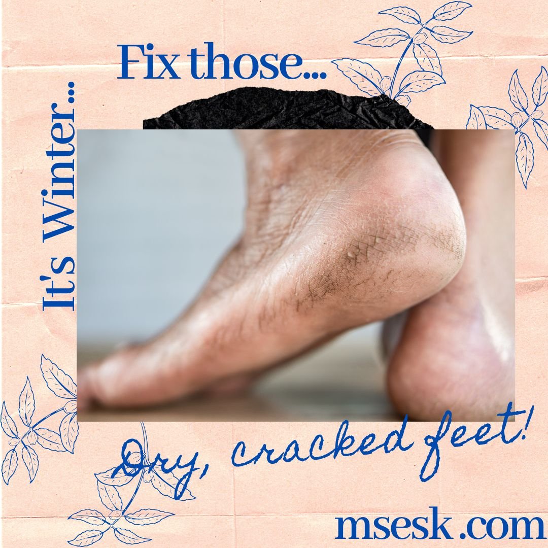 AaronSecrestMD's tweet photo. #winter can give you #dryfeet & #crackedskin but you don't have to accept defeat, get rid of it!
https://t.co/yC5XS8debE
#msesk #medicalsecrets #skincare #dermatology #dermatologist #dermatologia #skincaretips #skincareroutine #loveyourself @UtahDerm @UofUHealth @UdderlySmooth https://t.co/VzPbfZTCnp