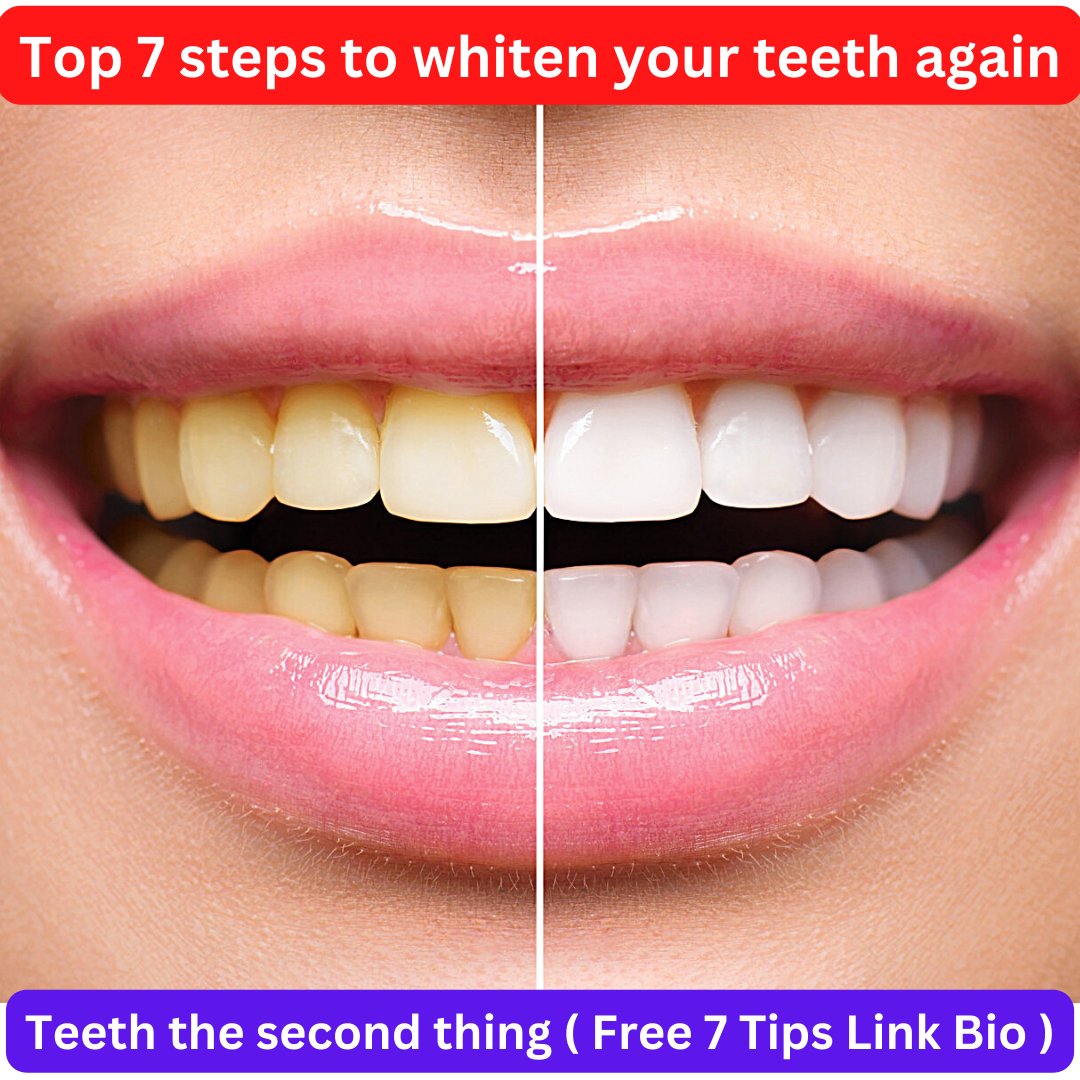 Madanjohn0123's tweet photo. Best Teeth Whitening At-Home | Teeth Whitening Products That Actually Work | Teeth Product

If You Really Whitening Your Teeth Check My Bio Link To Get ( Free PDF And Video ). 
#teeth #whiteteeth #TeethWhiteningAtHome #teeth #womenteethwhiteteethtips https://t.co/nR861zfGmZ
